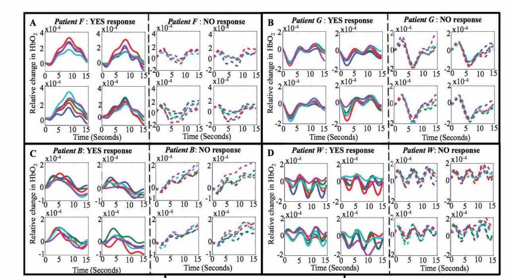 Rappresentazione delle variazioni emo-dinamiche dei 4 pazienti in relazione alle risposte "si" o "no" 