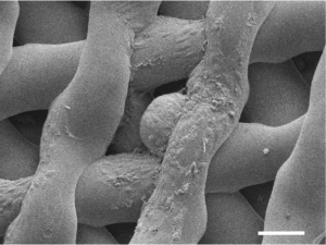 Immagine microscopica di un uovo immaturo di topo, circondato da cellule di sostegno, dopo che è stato ospitato in un'ovaia stampata in 3D per sei giorni. 