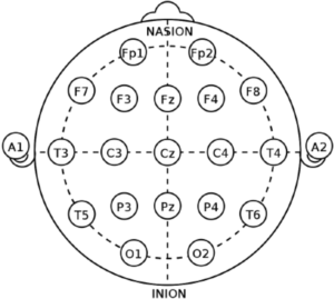 Posizionamento degli elettrodi secondo la configurazione 10-20