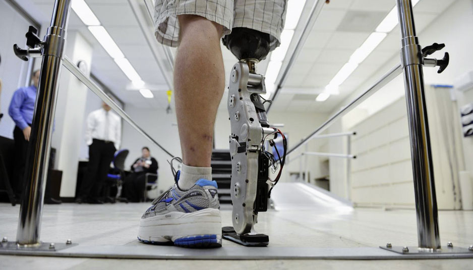 CYBERLEGs, Italian Project fot bionic legs, Close-up Engineering, Credits: cyberlegs.eu