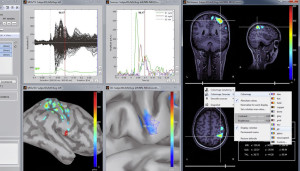 Brainstorm | MATLAB open source application