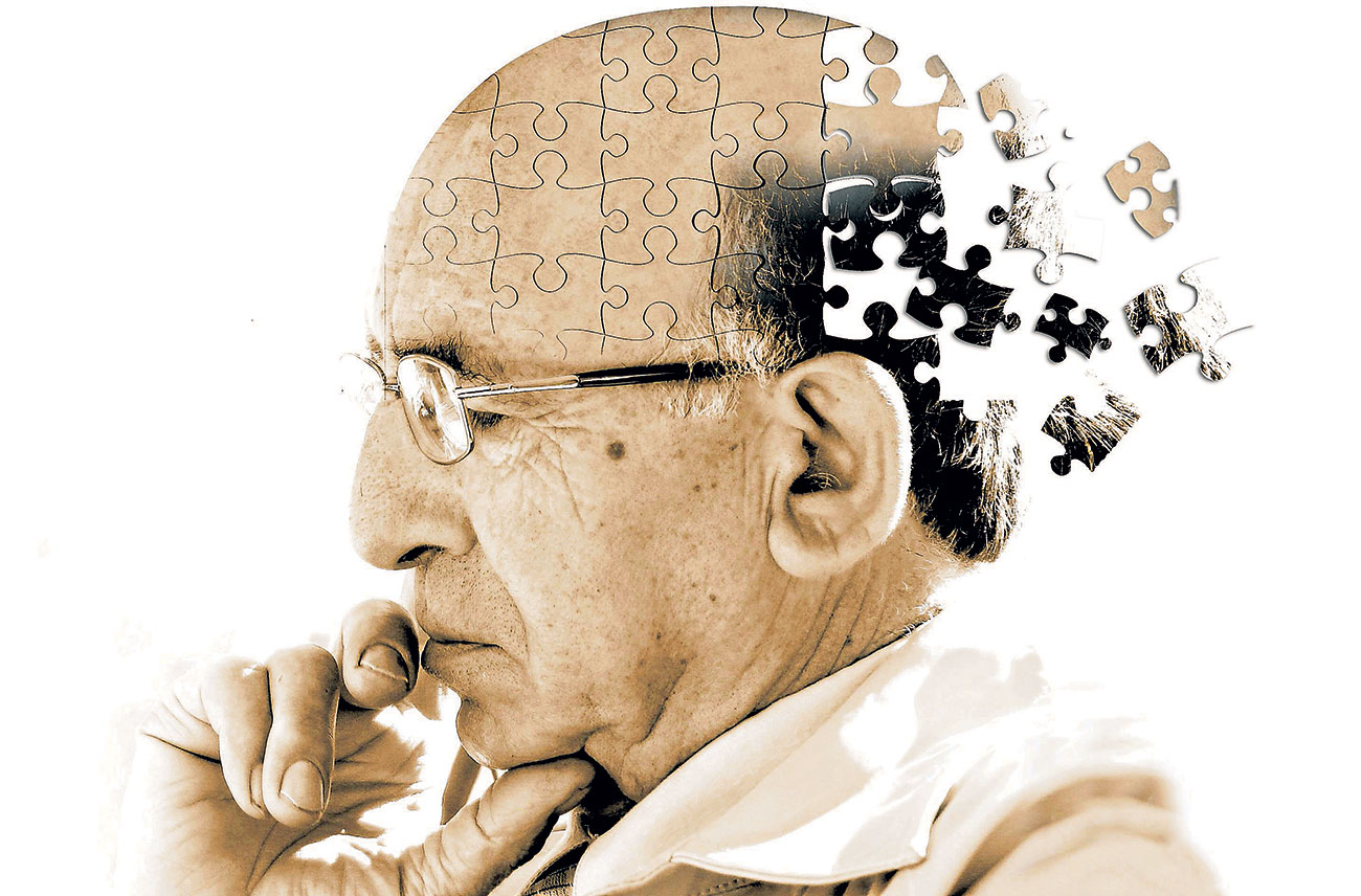 Alzheimer EEG brain