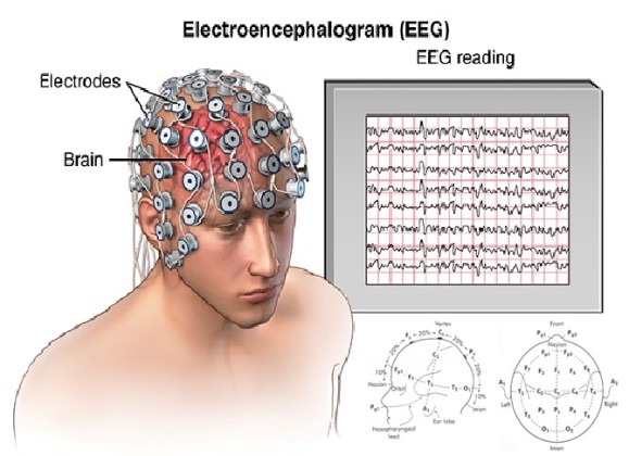 mild-cognitive-impairment-eeg-10-20-system-biomed-cuenews