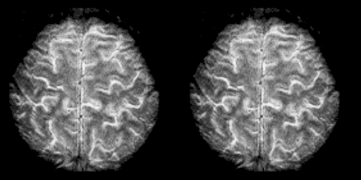 High resolution FMRI of the Human Brain.