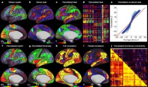 Una nuova mappa del cervello umano