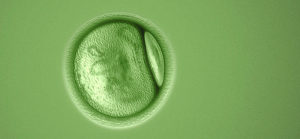 Green Cell