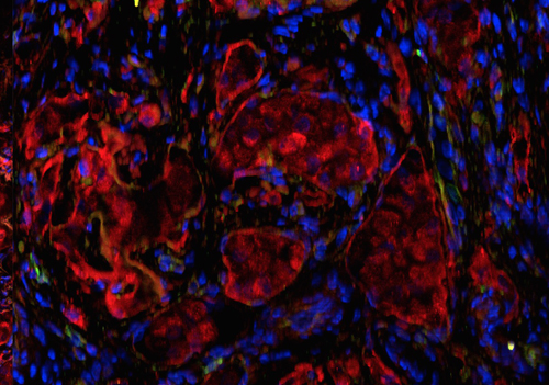 Microscopia a fluorescenza delle Isole di Langerahans nell’omento trapiantate all'interno dello scaffold biologico. In rosso è evidenziata l’insulina 