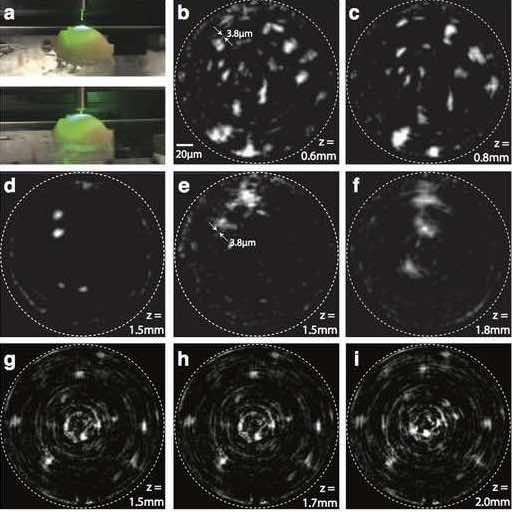 Cellule della microglia del cervello di un roditore osservate con la CCM: (a) fotografia del campione con la cannula in prossimità, (b-f) e (g-i) immagini ottenute a diverse profondità in due differenti campioni.