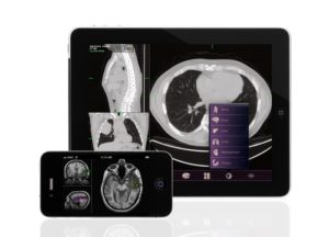 Web, App e Rete allungano la vita dei malati oncologici