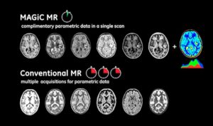 MAGIC - Magnetic Resonance in 6 minutes