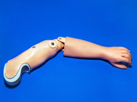 Arto protesico