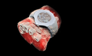 Ottenuta la prima scansione radiologica in 3D a colori