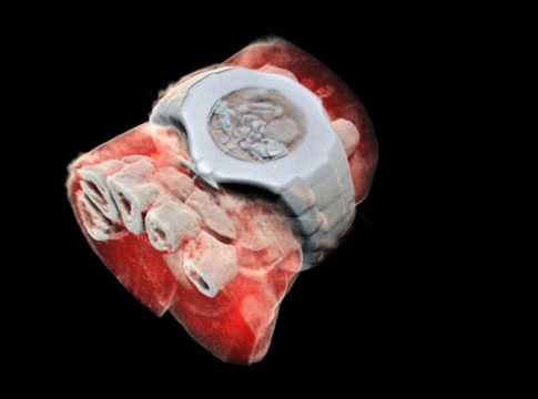 Ottenuta la prima scansione radiologica in 3D a colori