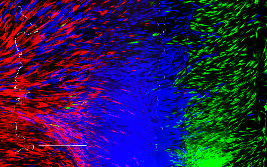 Legamenti e tendini stampati in 3D