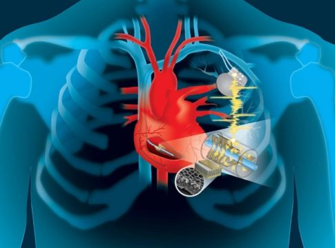Alimentare i pacemaker con i battiti del cuore: una soluzione possibile