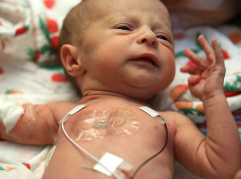 Sensori flessibili e senza fili per il monitoraggio dei neonati