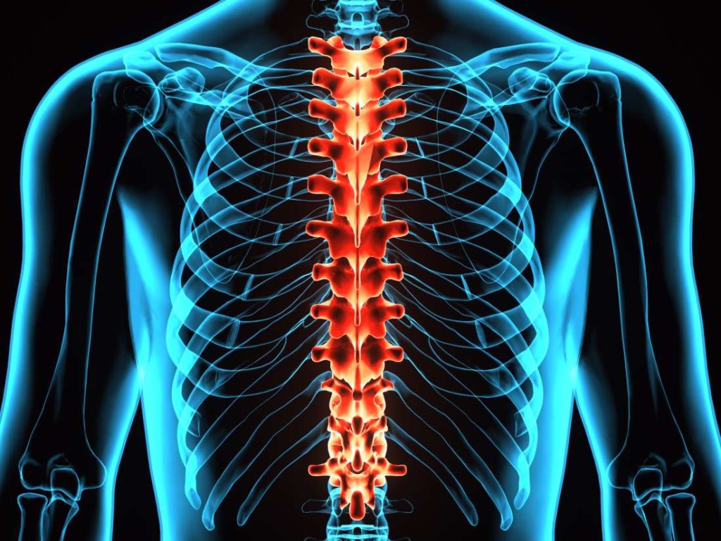 Altre 3 persone tornano a camminare grazie alla stimolazione spinale