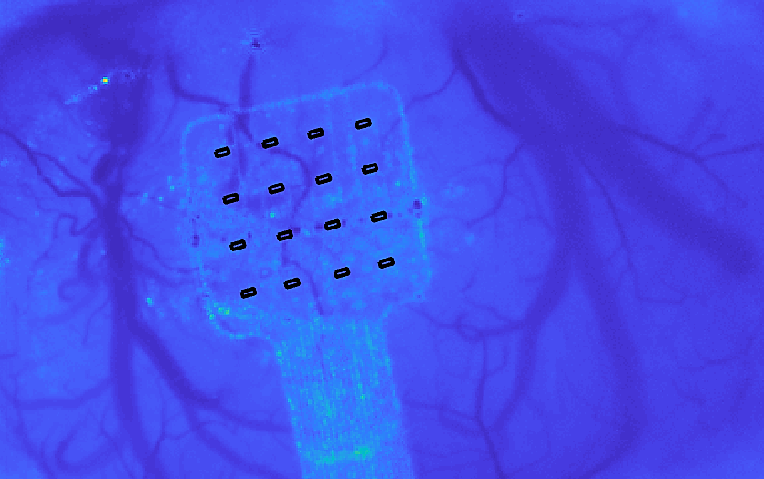 Nuovo impianto a base di grafene può sentire il cervello "sussurrare"