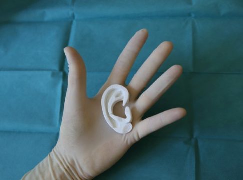 Stampa 3D: a Firenze ricostruito da zero l'orecchio ad un bambino