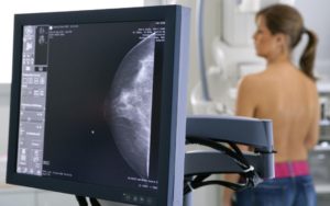 tumore al seno prevenzione ottobre mammografi mammografia