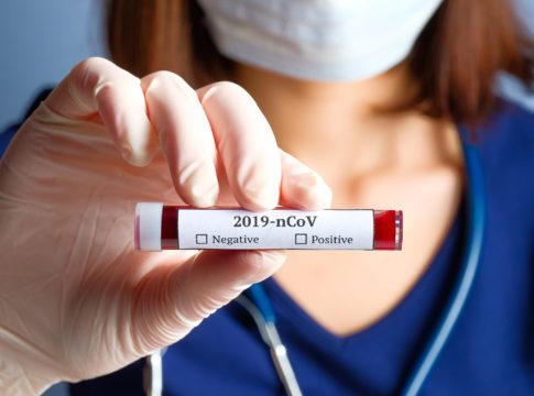 Coronavirus: quanti test ha fatto l’Italia?
