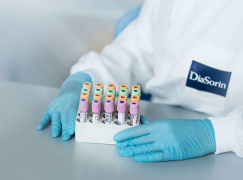 Coronavirus: DiaSorin, un’eccellenza italiana per la diagnostica. Credits: DiaSorin