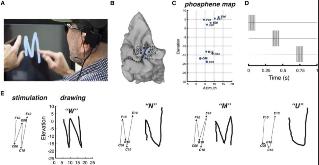 cecità cervello occhio elettrodi fosfeni 