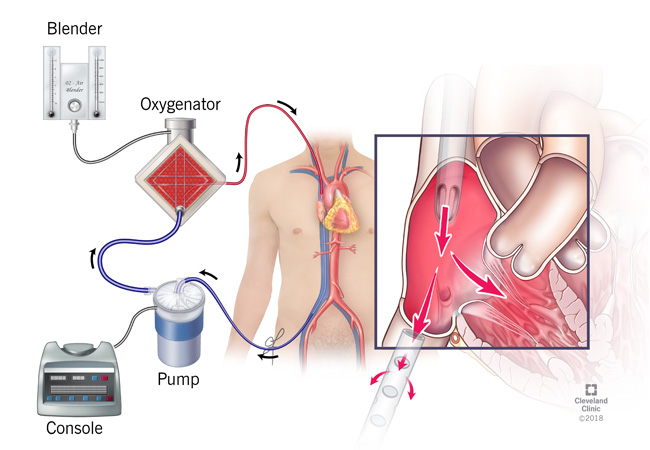 Trapianto di fegato: organo tenuto in vita per quasi un giorno prima dell’operazione.