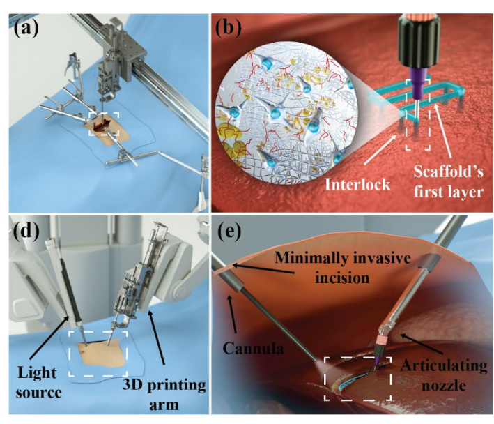 Nuovi traguardi nella stampa 3D: ora è possibile anche all’interno del corpo