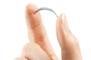 Essure anticoncezionale danni