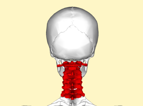 Protesi vertebrale 3D restituisce il movimento a paziente tetraplegico