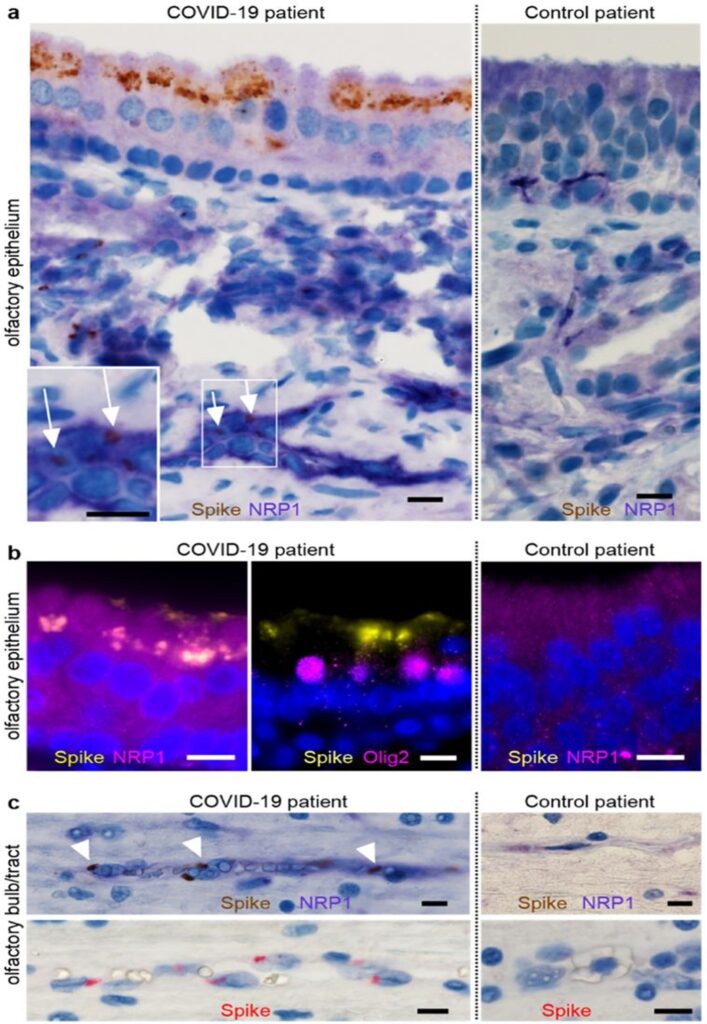 neuropilina covid