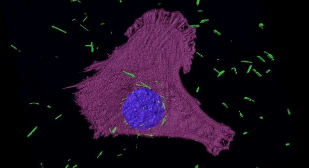 Trattamento mesotelioma