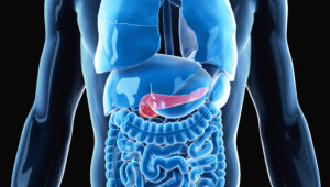 Tumore del pancreas: nuova strategia con vaccino e chemioterapia