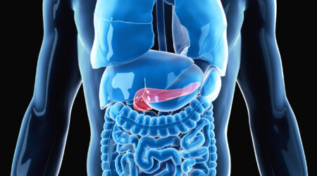 Cancro al pancreas: una nuova scoperta promettente?