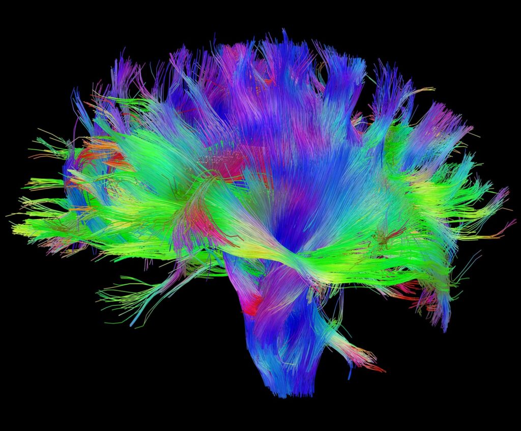 Risonanza magnetica con DTI: l’importante strumento per il neuroimaging. Credits: humanconnectomeproject.org