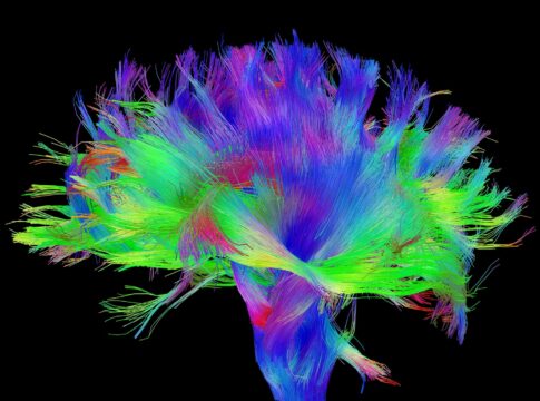 Risonanza magnetica con DTI: l’importante strumento per il neuroimaging. Credits: humanconnectomeproject.org