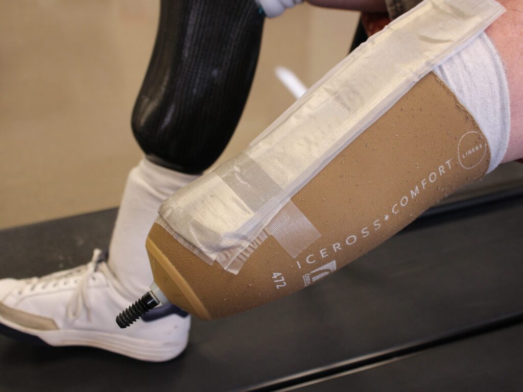 Sensori di pressione su base tessile: un nuovo modo di vivere la protesi. Credit: North Carolina State University