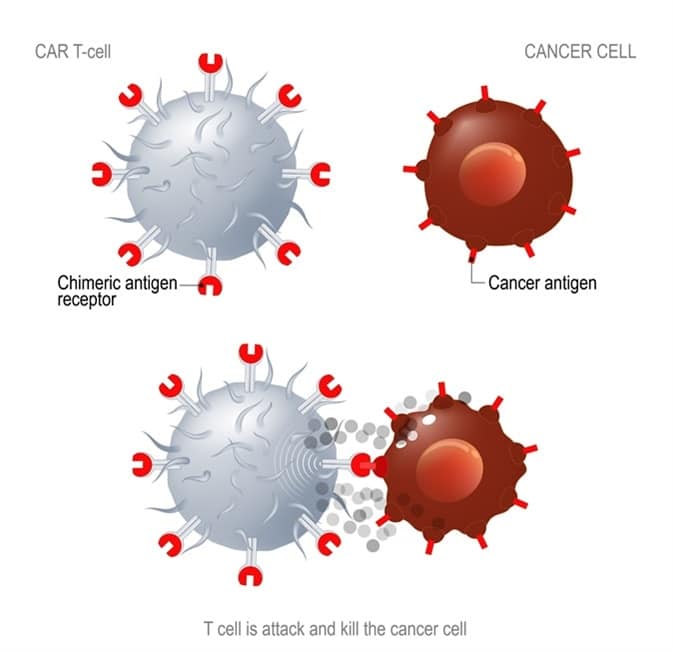 Leucemia: primi tre bambini trattati con successo grazie alla terapia con cellule CAR-T