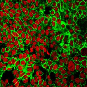 Un test non invasivo rileva le cellule del cancro e ne individua la posizione. Credits: NCI Center for Cancer Research