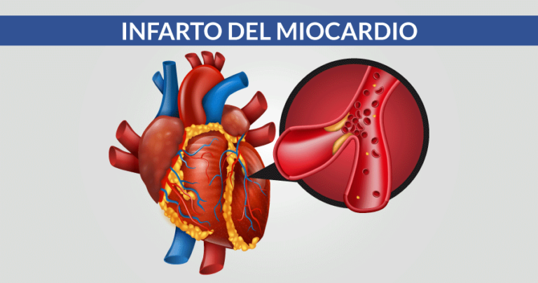 Miocardite: Cos'è, Sintomi, Cause E Diagnostica Della Malattia ...