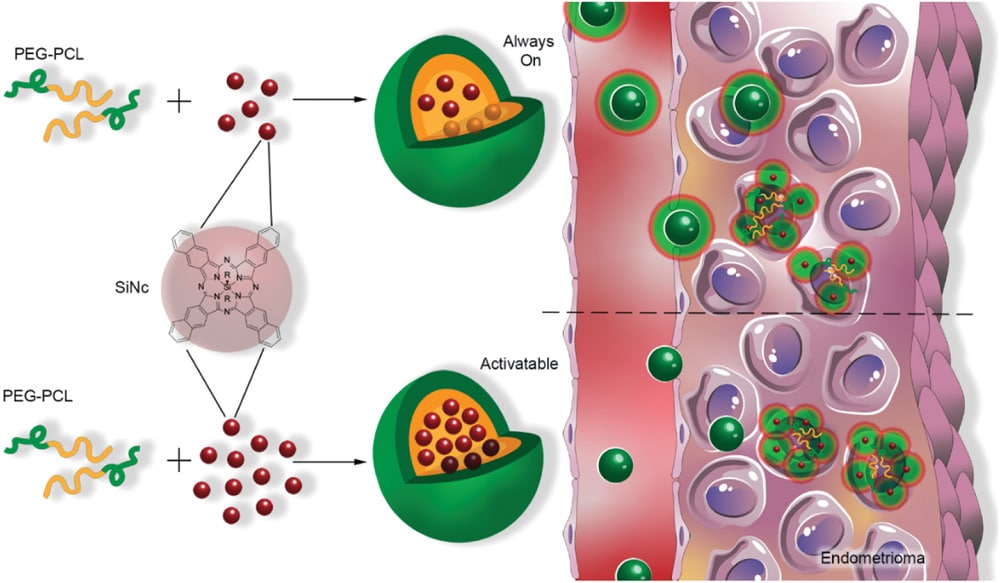 Nanopolimeri fotosensibili come strumento di imaging e terapia per l’endometriosi
