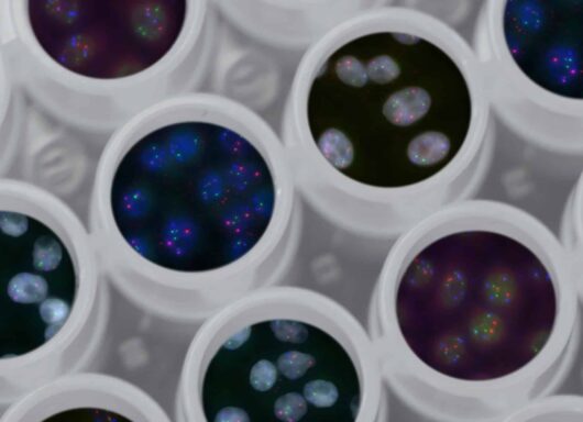 Genoma: ‘vernice spray’ mette in evidenza la materia oscura