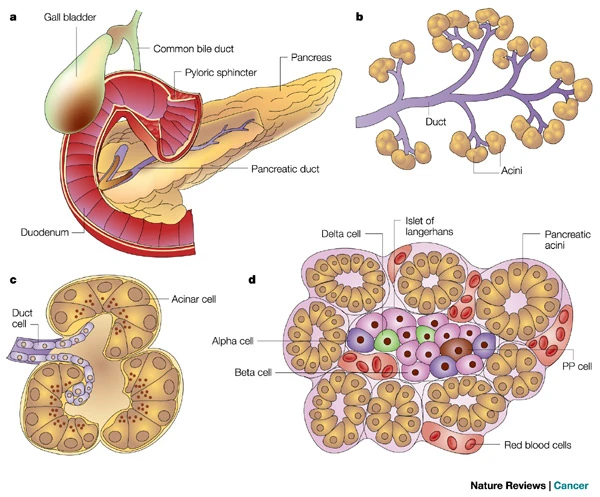 cancro al pancreas