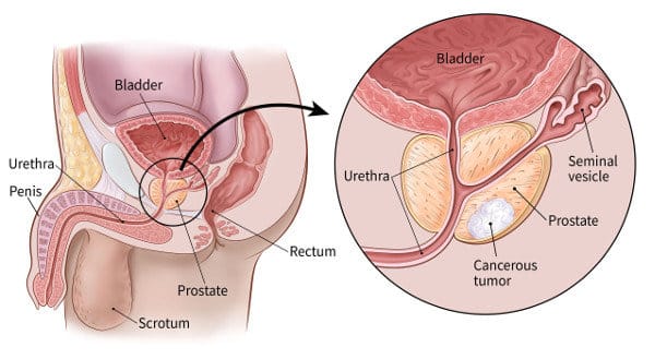 Struttura prostata