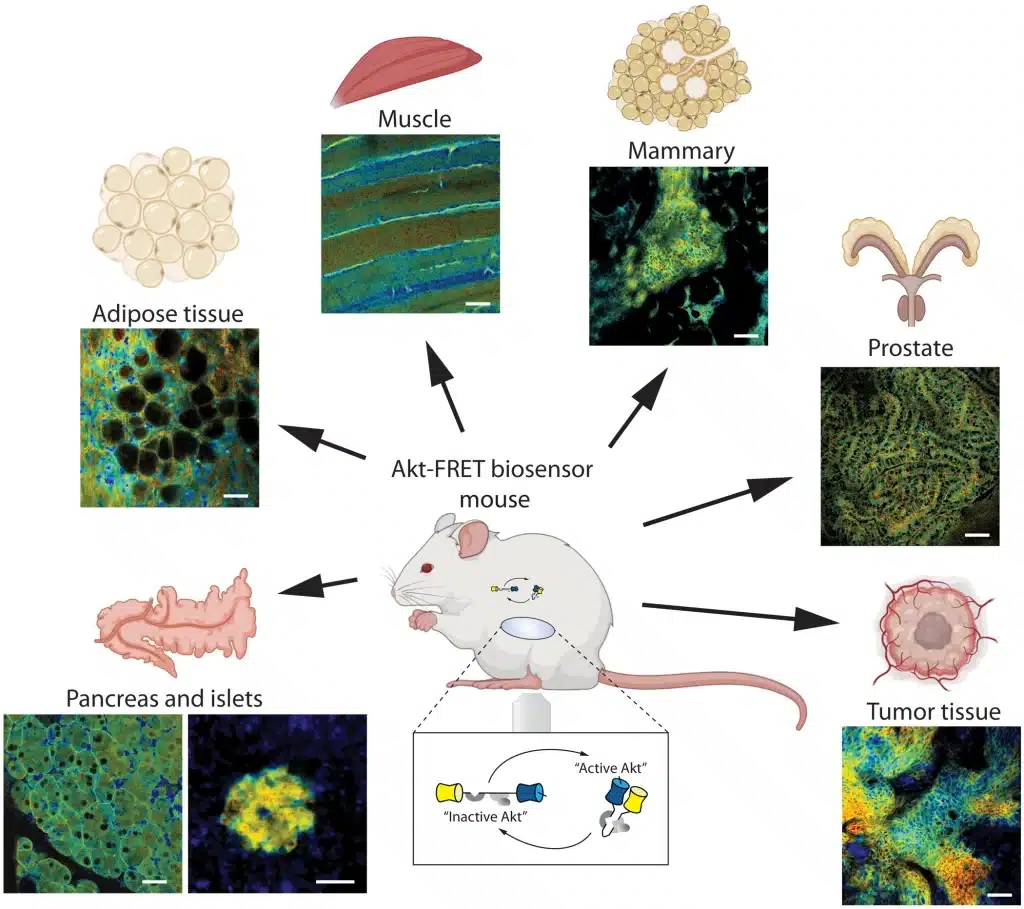 cancro al pancreas akt