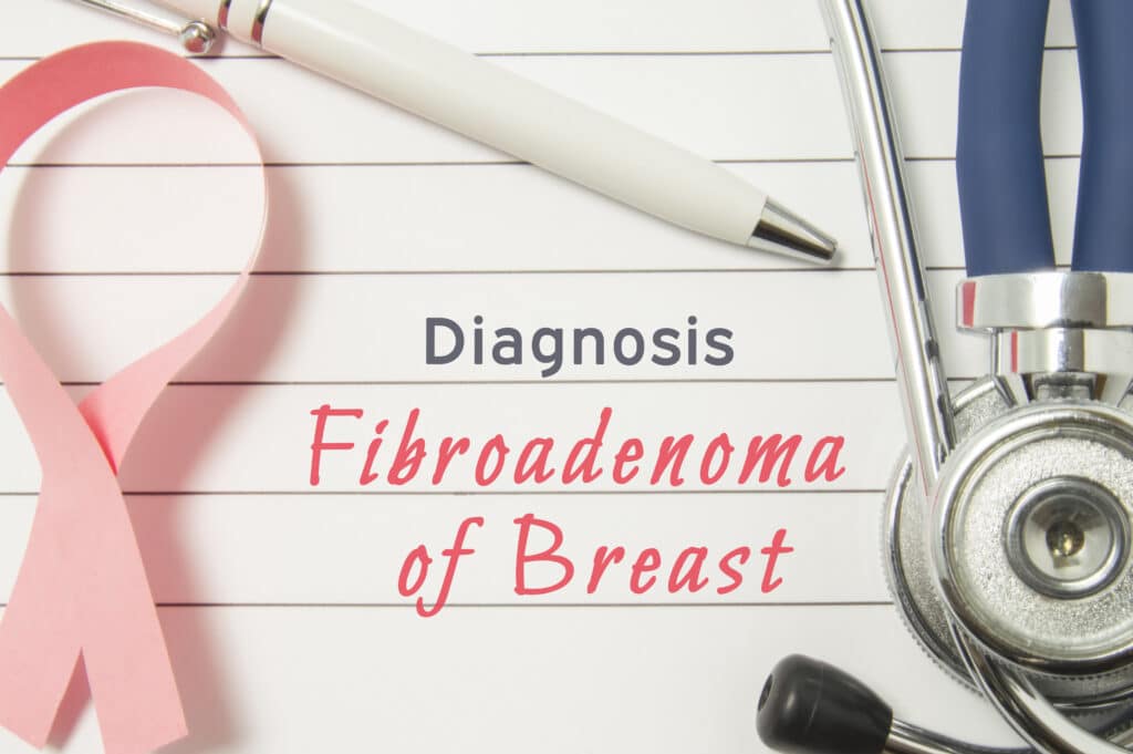 fibroadenoma