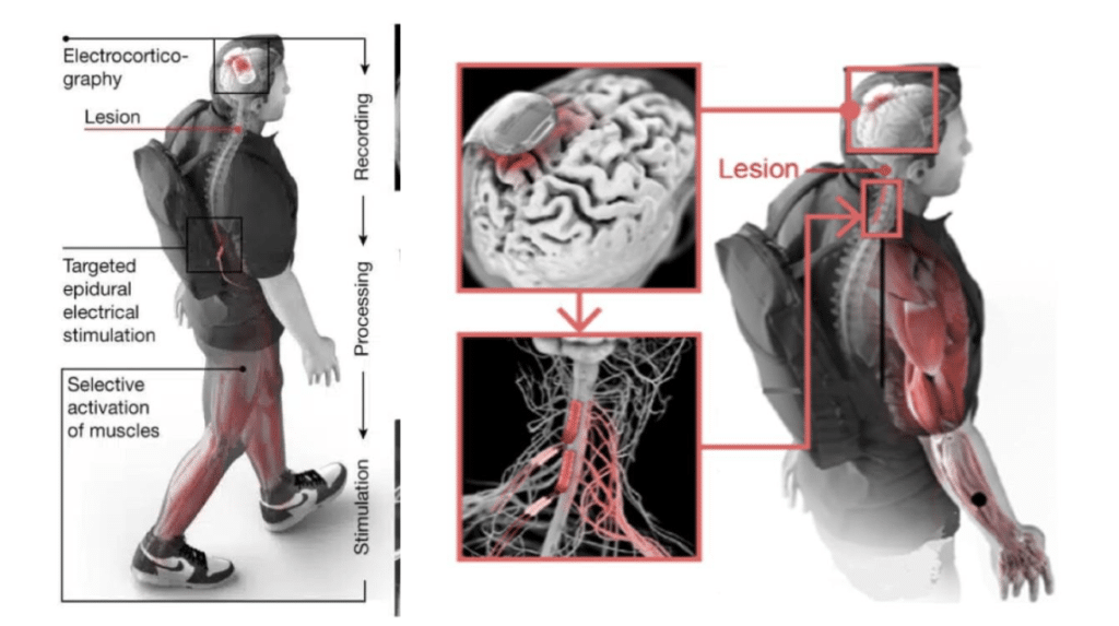 Brain Spine Interface